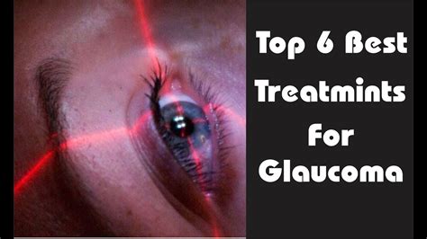 drops for glaucoma test|best drops for glaucoma treatment.